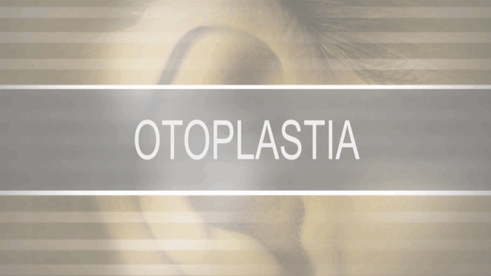 Otoplastia