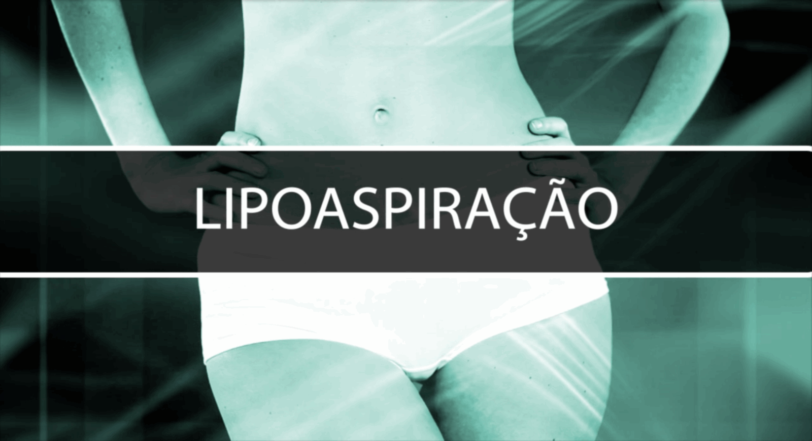 Lipoaspiração