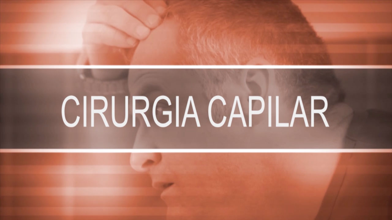 Cirurgia capilar