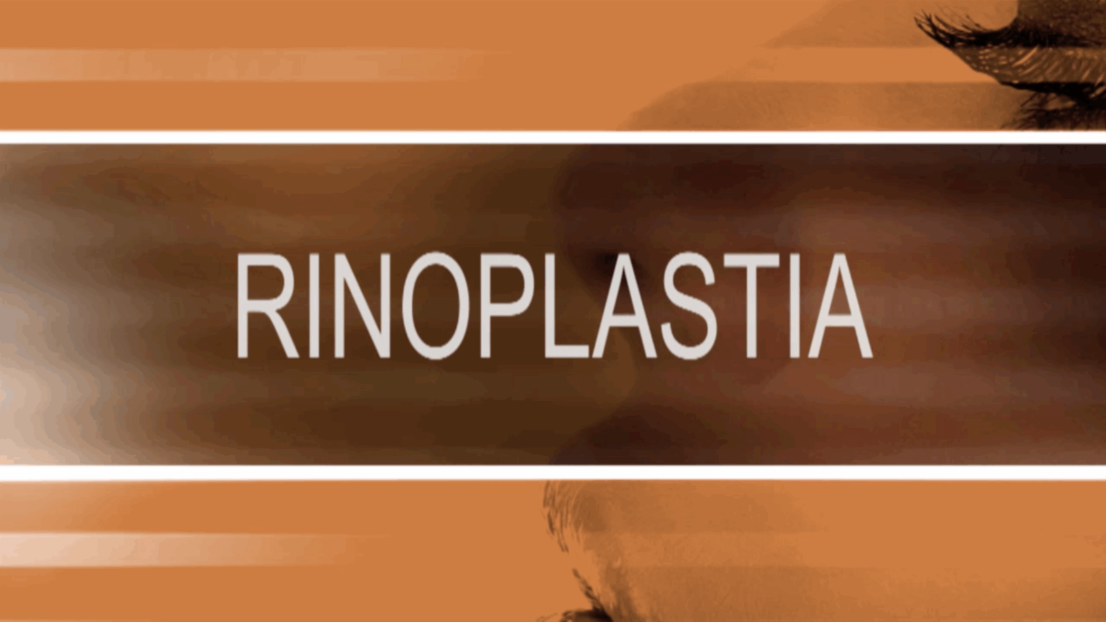 Rinoplastia