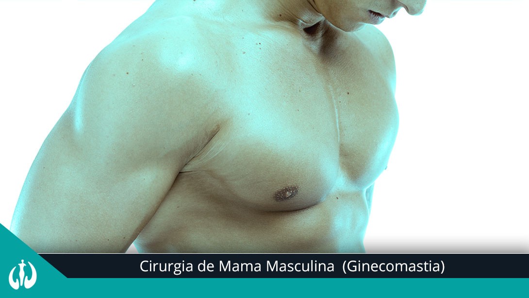 Ginecomastia – Cirurgia de Mama Masculina