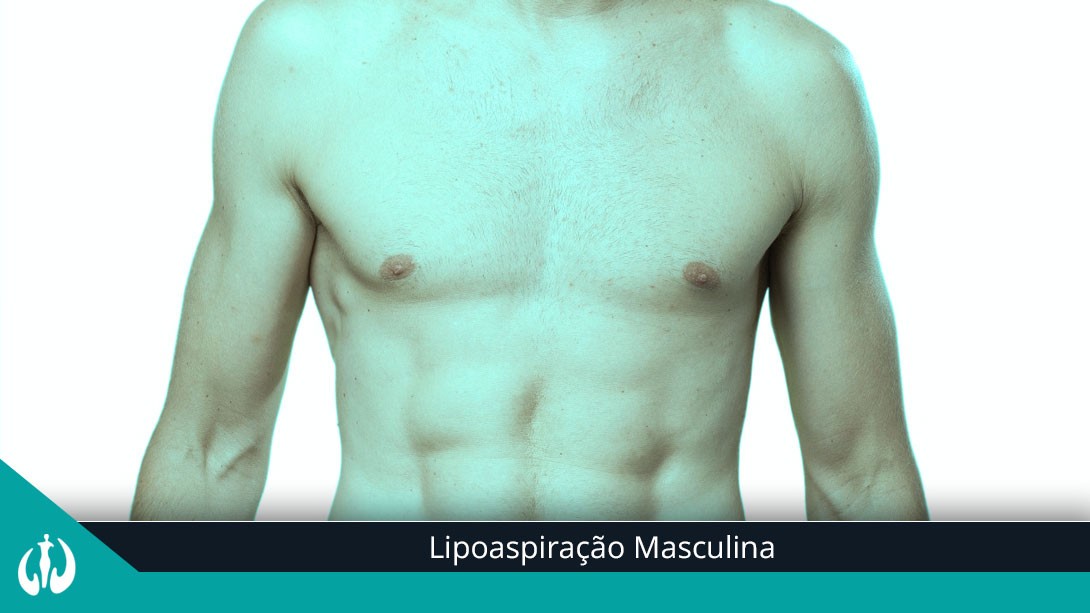 Lipoaspiração Masculina