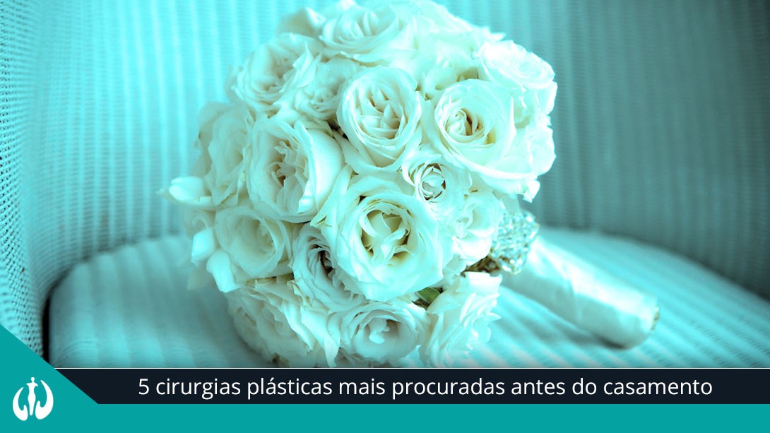 5 cirurgias plásticas mais procuradas antes do casamento