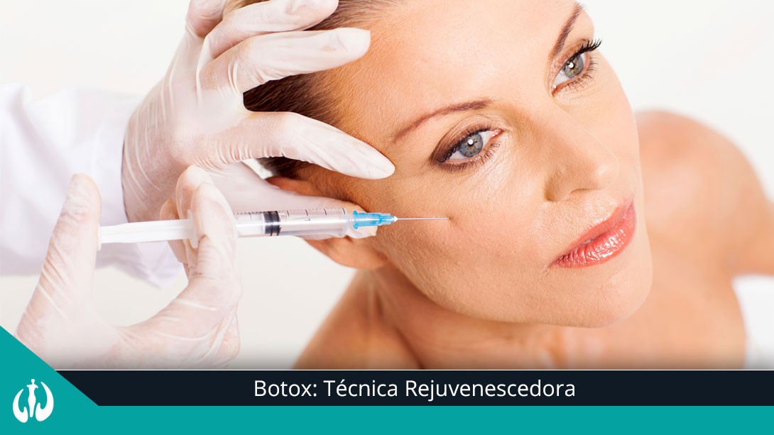 Toxina Botulínica técnica rejuvenescedora