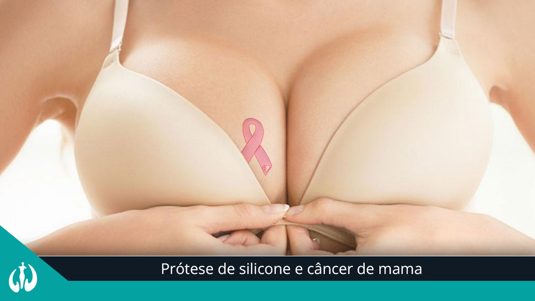 Prótese de silicone e câncer de mama