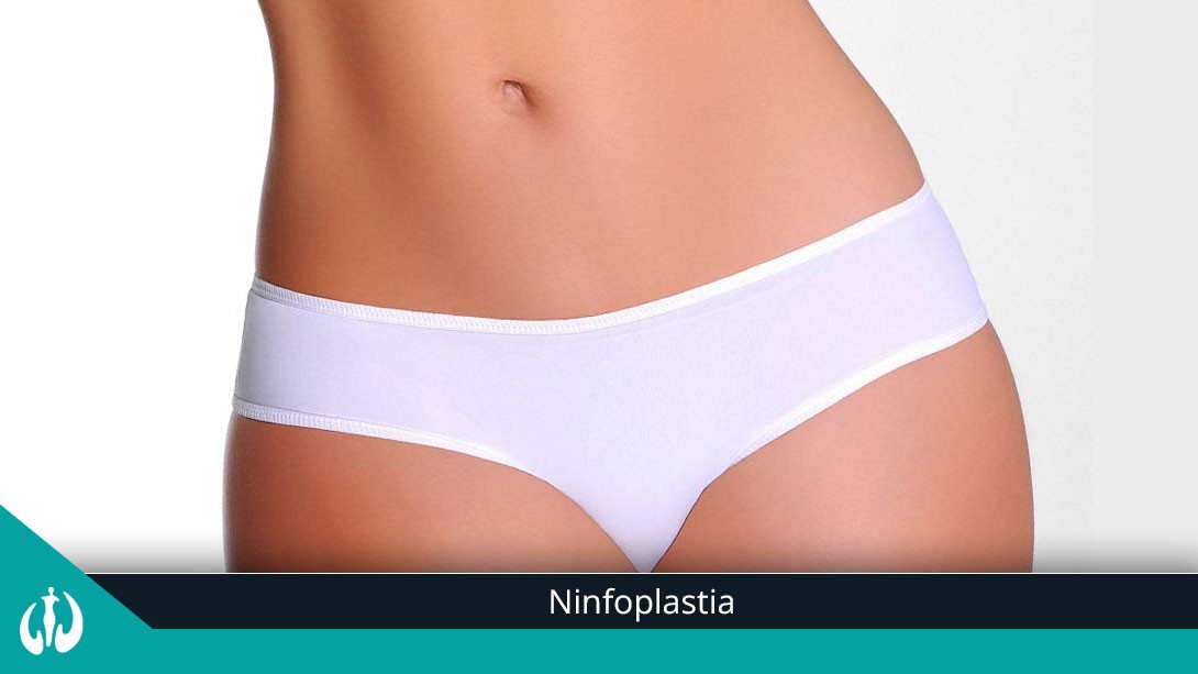 Ninfoplastia