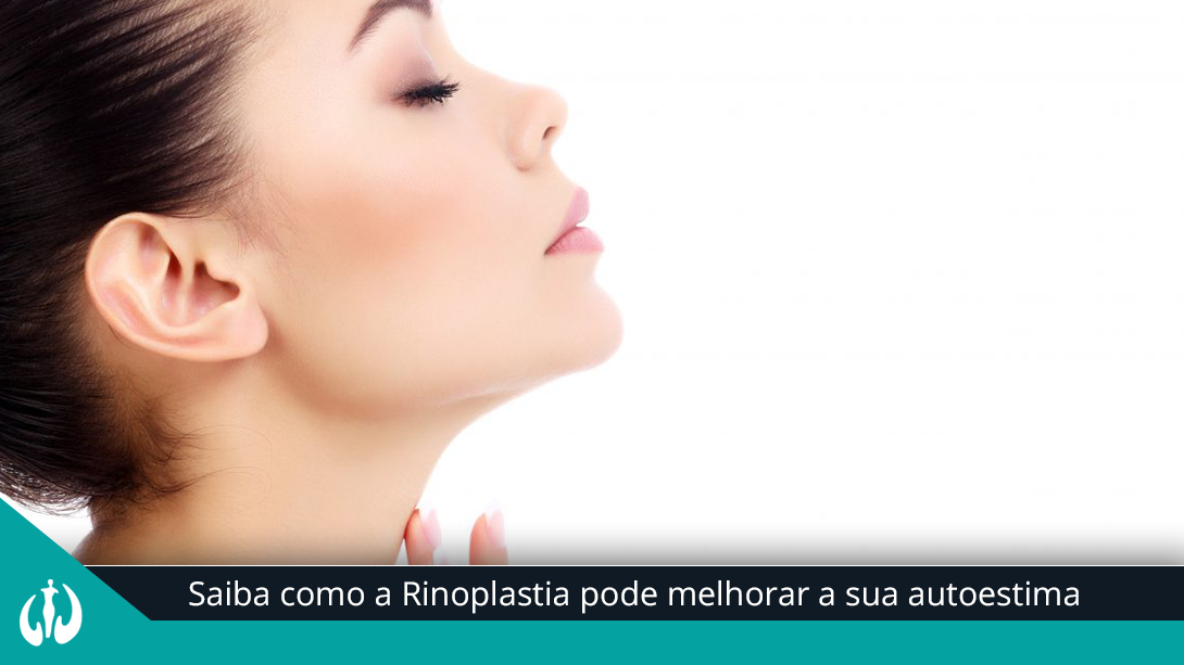 Saiba como a Rinoplastia pode melhorar a sua autoestima