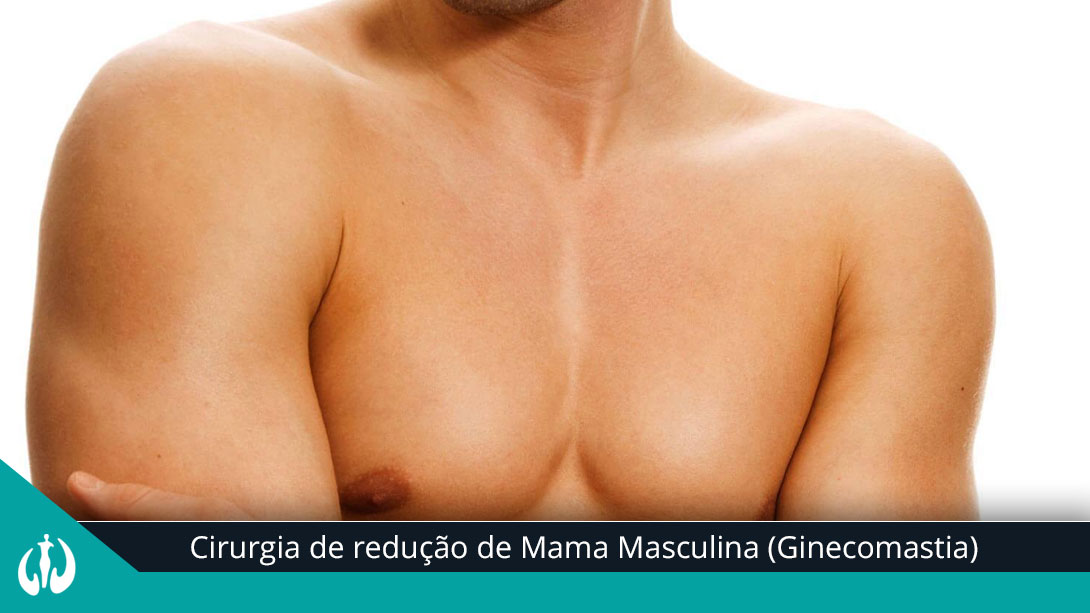 Cirurgia de redução de Mama Masculina (Ginecomastia)