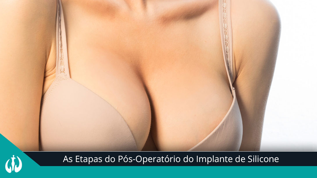 As Etapas do Pós-Operatório do Implante de Silicone