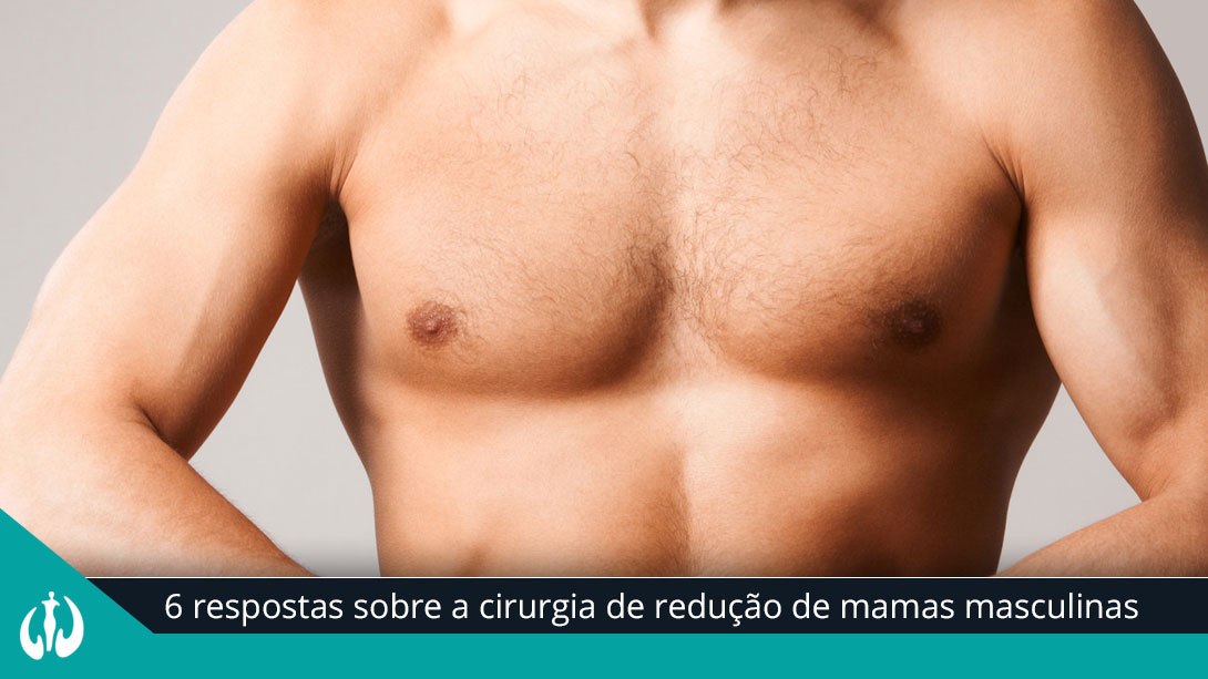 6 respostas sobre a cirurgia de redução de mamas masculinas