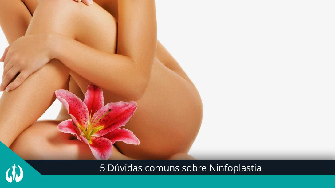 5 Dúvidas comuns sobre Ninfoplastia