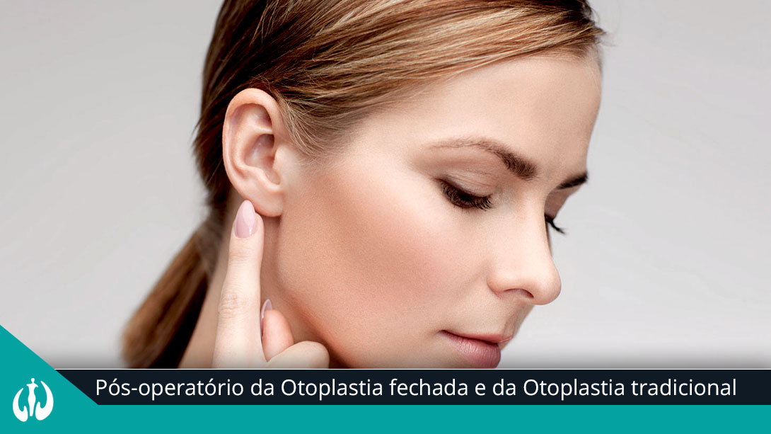 Pós-operatório da Otoplastia fechada e da Otoplastia tradicional