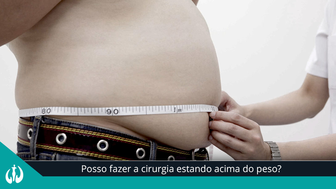 Posso fazer a cirurgia estando acima do peso?
