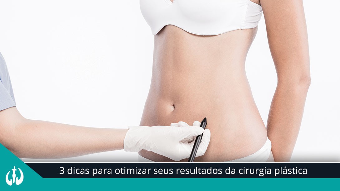 3 dicas para otimizar seus resultados da cirurgia plástica