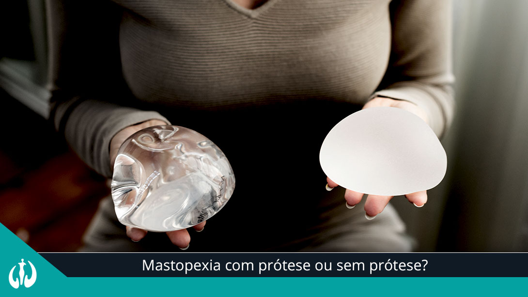 Mastopexia com prótese ou sem prótese?