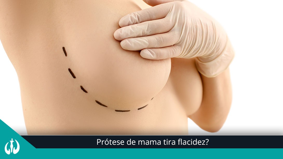 Prótese de mama tira flacidez?