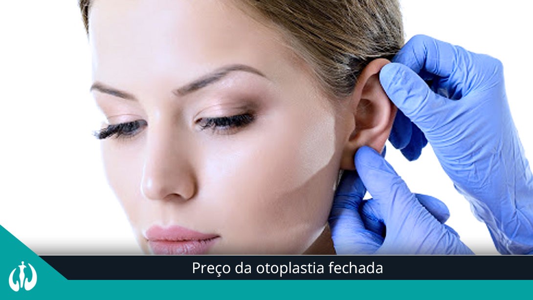 Preço da Otoplastia Fechada