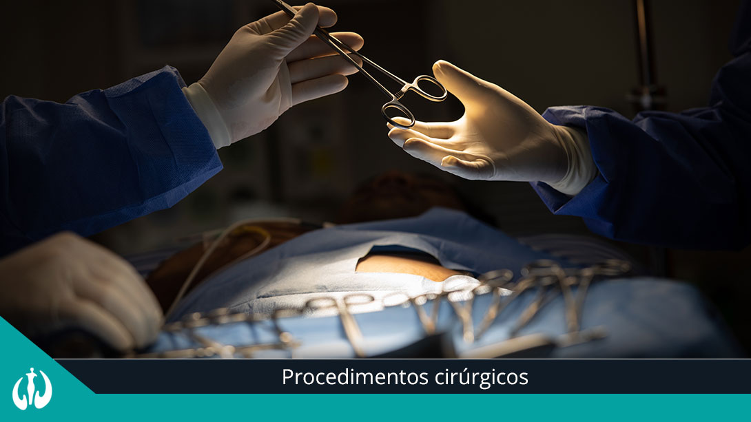 Procedimentos Cirúrgicos
