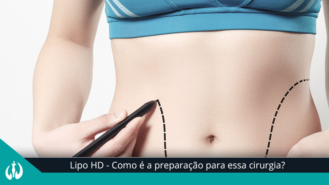 Lipo HD – Como é a preparação para essa cirurgia?