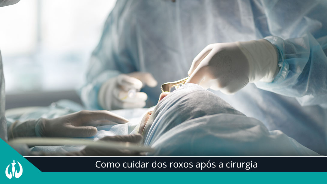 Como cuidar dos roxos após a cirurgia