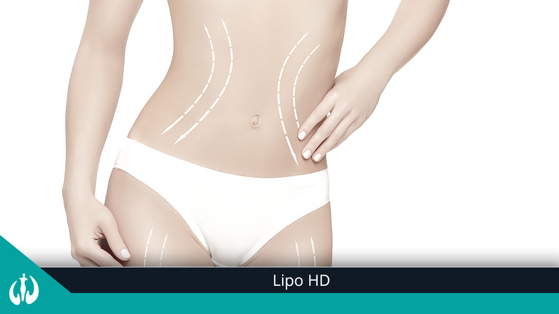 Lipo HD – tudo que você precisa saber!