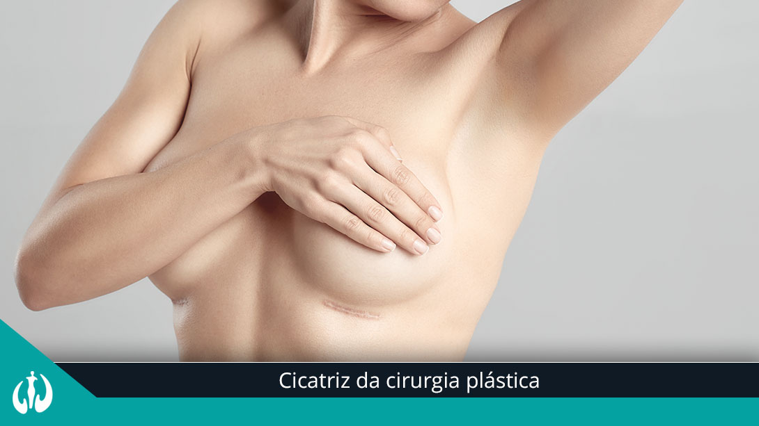 Cicatriz da cirurgia plástica