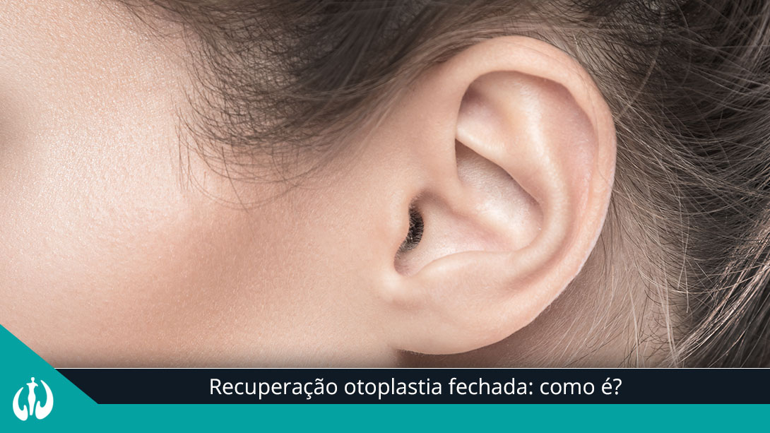Recuperação otoplastia fechada: como é?