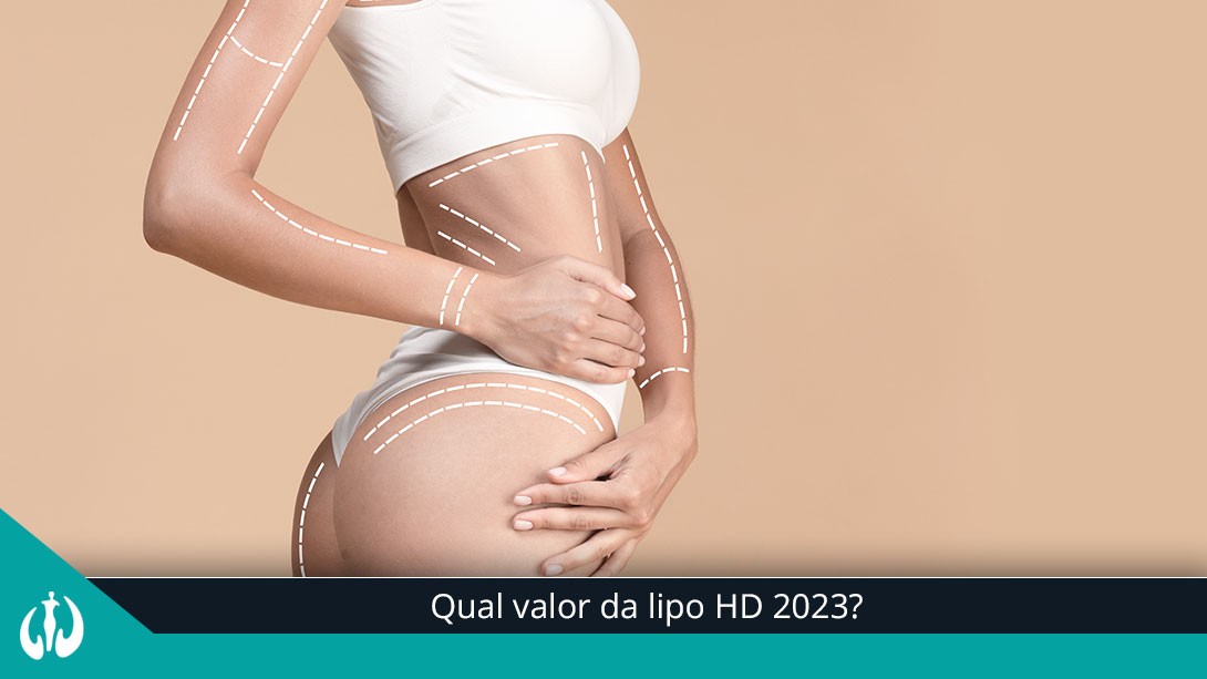 Qual valor da lipo HD 2023?